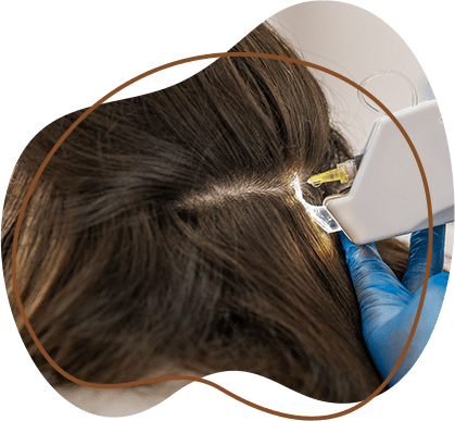 laser light hair treatment