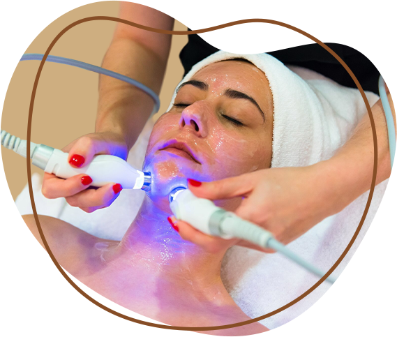Laser treatment FOR skin tighetening