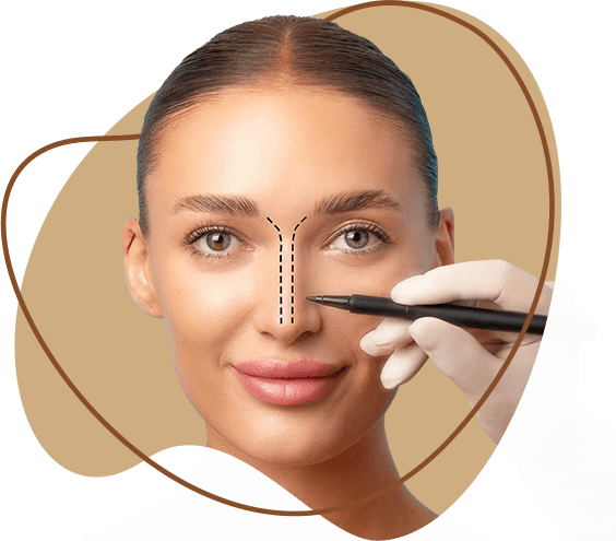 Nose surgery