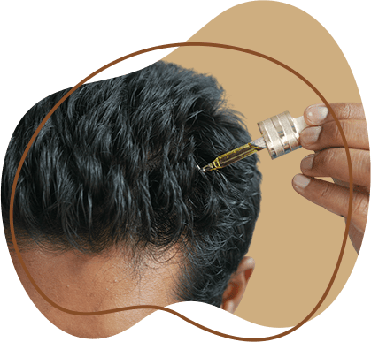 Hair growth treatment