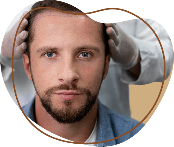 Step wise baldness treatment