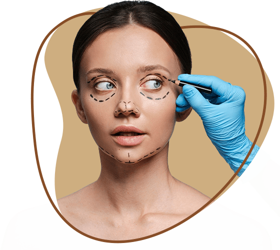 Blephroplasty