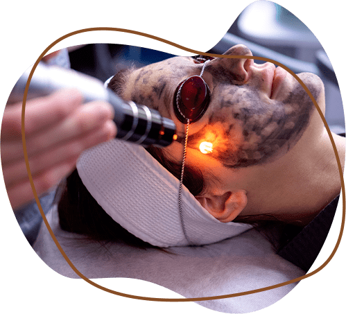 Laser Face lightening