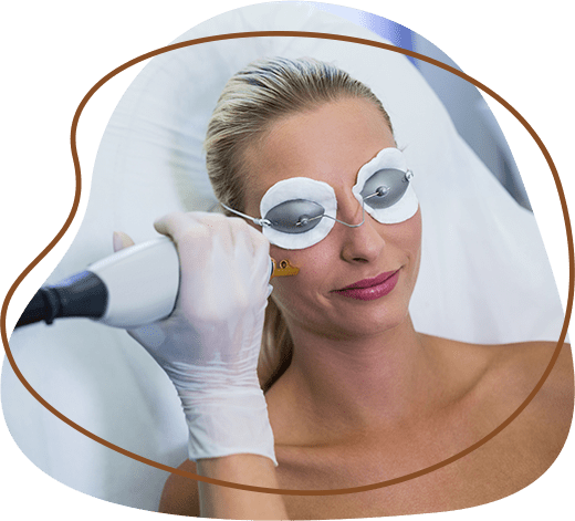 Laser undereye darkness treatment
