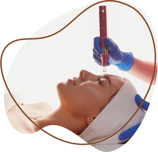 Micro-needling