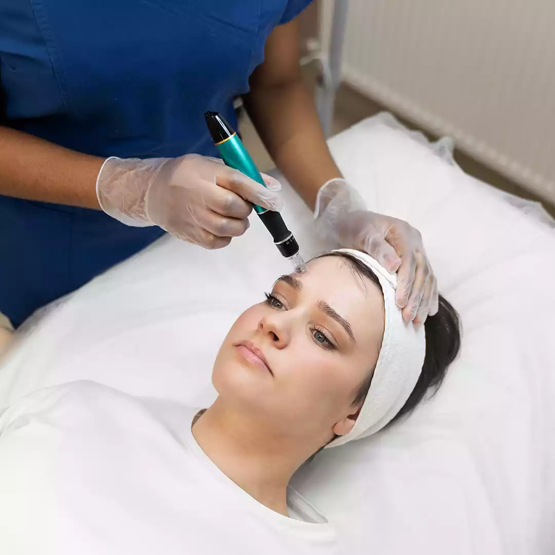 Micro needling