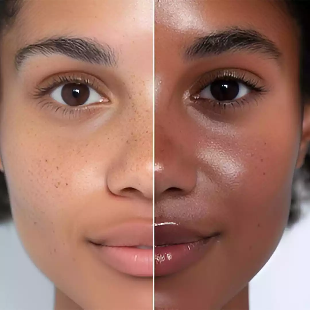 Skin Pigmentation Correction