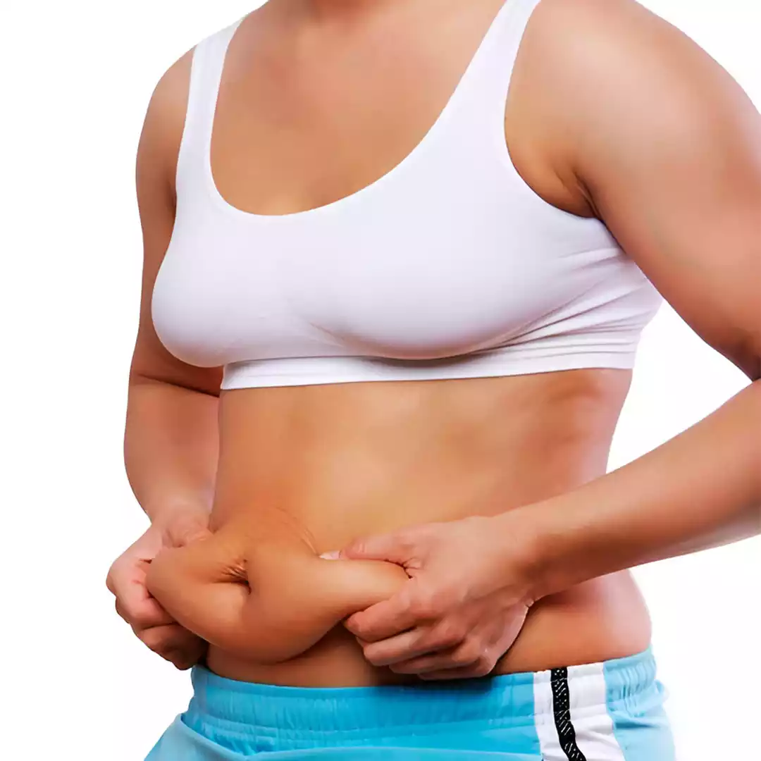Tummy Tuck (Abdominoplasty)