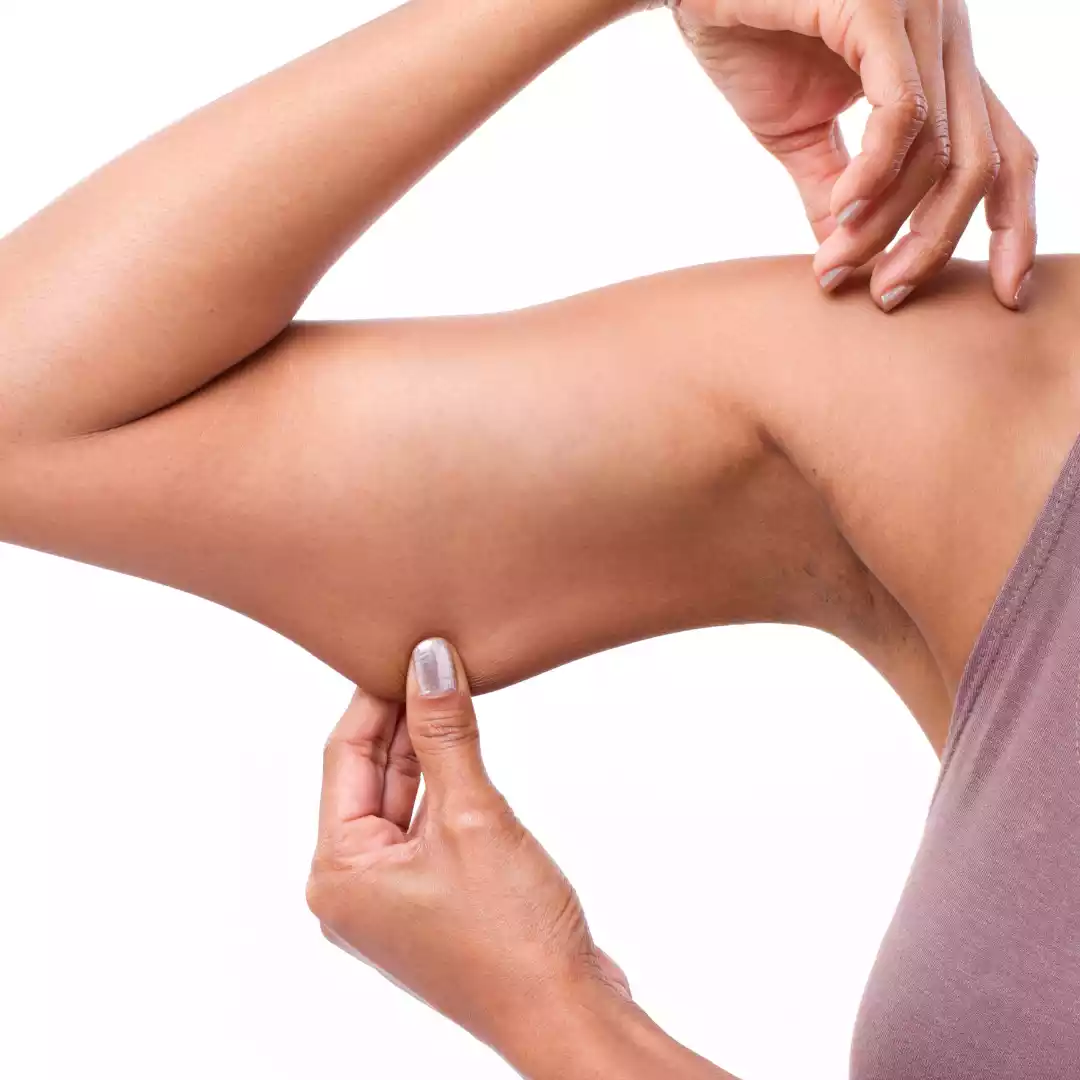 Arm Reduction