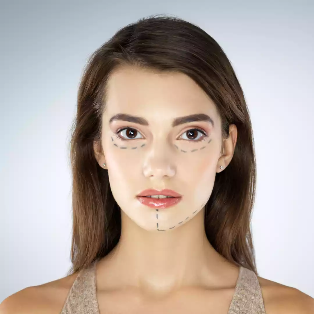Blepharoplasty for Saggy Eyelids