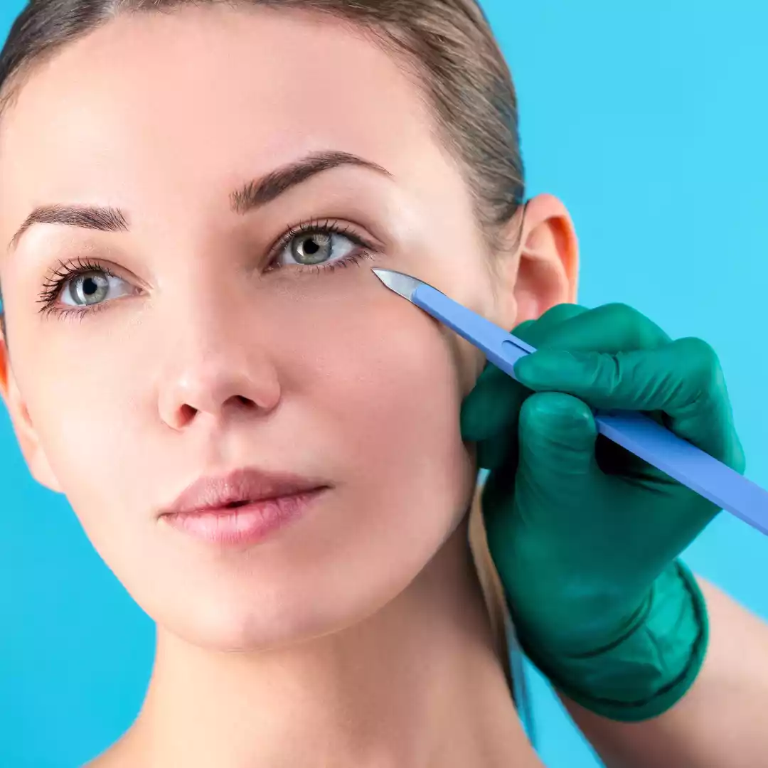 Blepharoplasty for Under Eye Bags