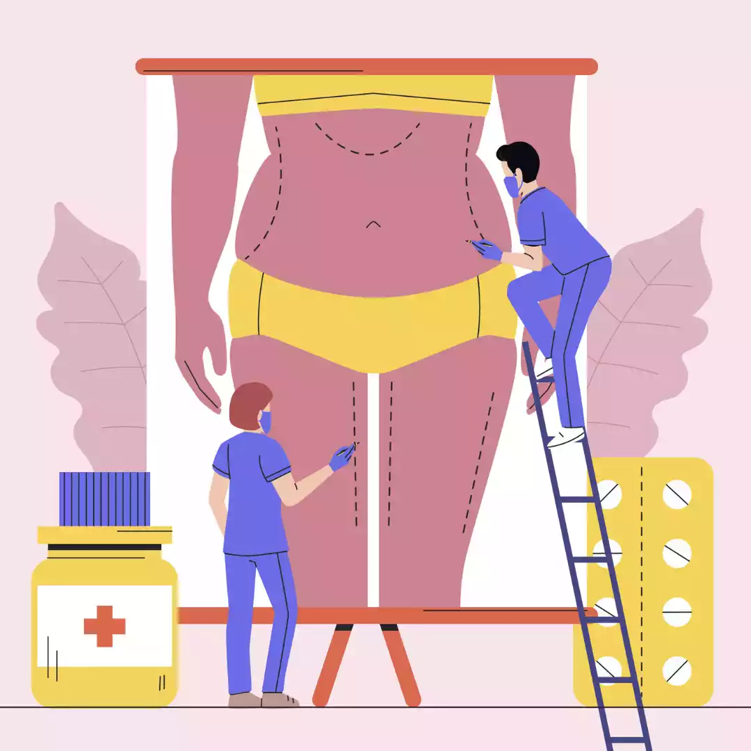 Bottom Surgery