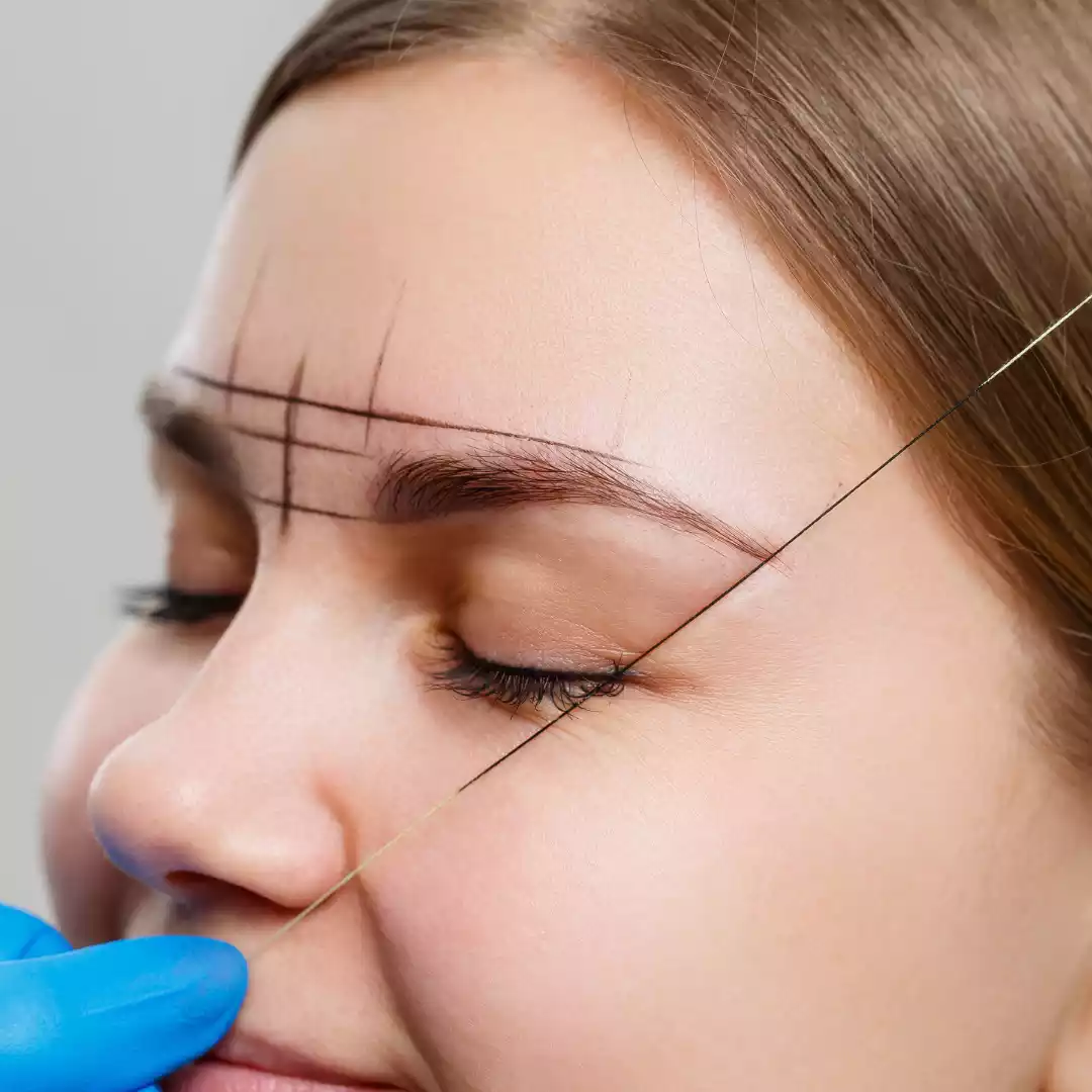 Browlift